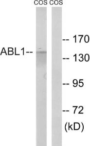 Western blot analysis of lysates from COS7 cells, treated with calyculin A 50ng/ml 30' using Anti-ABL1 Antibody. The right hand lane represents a negative control, where the antibody is blocked by the immunising peptide