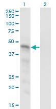 Anti-SNX15 Mouse Monoclonal Antibody [clone: 1D4]