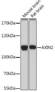 Western blot analysis of extracts of various cell lines, using Anti-Axin 2 Antibody (A93038) at 1:1,000 dilution. The secondary antibody was Goat Anti-Rabbit IgG H&L Antibody (HRP) at 1:10,000 dilution.