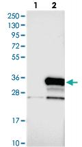 Anti-N4BP2L1 Rabbit Polyclonal Antibody