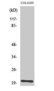 Western blot analysis of various cells using Anti-TRAPPC3 Antibody