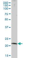 Anti-RNF170 Mouse Polyclonal Antibody