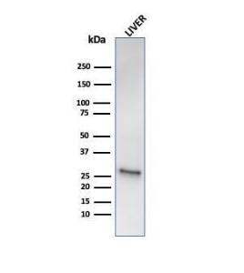 Antibody anti-HSP27 HSPB16490R 100 µg