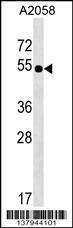 Anti-SLC9B2 Rabbit Polyclonal Antibody (AP (Alkaline Phosphatase))