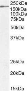 Anti-DSCAM Antibody (A83347) (2 µg/ml) staining of HepG2 cell lysate (35 µg protein in RIPA buffer). Detected by chemiluminescence