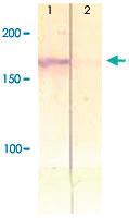 Anti-IRS1 Rabbit Polyclonal Antibody