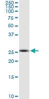 Anti-RNF170 Mouse Monoclonal Antibody [clone: 2D6]