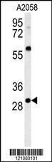 Anti-GSTO2 Rabbit Polyclonal Antibody (AP (Alkaline Phosphatase))