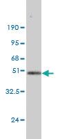 Anti-DUSP14 Mouse Monoclonal Antibody [clone: 4B5-E6]