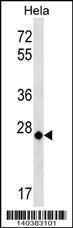 Anti-MT-CO3 Rabbit Polyclonal Antibody (Biotin)