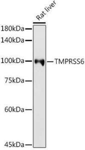 Western blot analysis of extracts of Rat liver, using Anti-Matriptase 2 Antibody (A8702) at 1:1,000 dilution