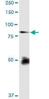 Anti-FBLN1 Rabbit Polyclonal Antibody