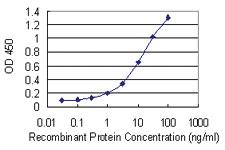 Anti-RNF170 Mouse Monoclonal Antibody [clone: 2D6]