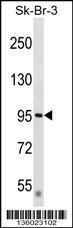 Anti-DTX3L Rabbit Polyclonal Antibody (AP (Alkaline Phosphatase))