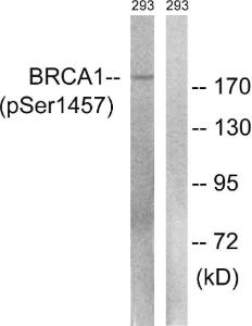 Western blot analysis of lysates from 293 cells treated with epo 20U/ml 15' using Anti-BRCA1 (phospho Ser1457) Antibody The right hand lane represents a negative control, where the antibody is blocked by the immunising peptide