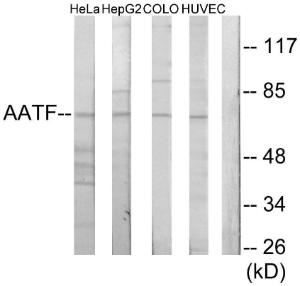 Anti-AATF antibody