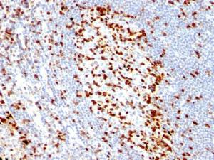 Immunohistochemical analysis of formalin-fixed, paraffin-embedded human tonsil using Anti-ZAP70 Antibody [ZAP70/528]