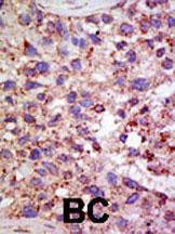 Anti-USP11 Rabbit Polyclonal Antibody