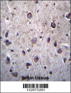 Anti-DOC2A Rabbit Polyclonal Antibody (APC (Allophycocyanin))