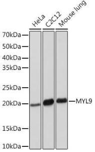 Western blot analysis of extracts of various cell lines, using Anti-MYL9 Antibody [ARC1284] (A307859) at 1:1000 dilution. The secondary Antibody was Goat Anti-Rabbit IgG H&L Antibody (HRP) at 1:10000 dilution. Lysates/proteins were present at 25 µg per lane