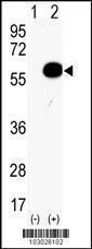 Anti-AKT2 Rabbit Polyclonal Antibody (HRP (Horseradish Peroxidase))