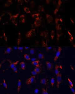 Immunofluorescence analysis of C6 cells using Anti-CD44 Antibody (A309094) at a dilution of 1:100. DAPI was used to stain the cell nuclei (blue).