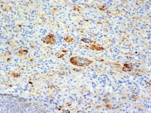 Anti-TNF alpha Mouse Monoclonal Antibody [clone: TNFA/1172]