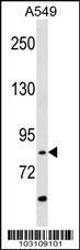 Anti-RIPK4 Rabbit Polyclonal Antibody (FITC (Fluorescein))