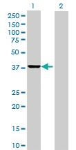 Anti-SAE1 Mouse Polyclonal Antibody