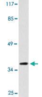 Anti-GPR119 Rabbit Polyclonal Antibody