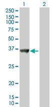 Anti-SNX11 Mouse Polyclonal Antibody