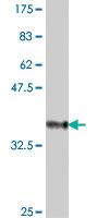 Anti-SMARCB1 Mouse Polyclonal Antibody