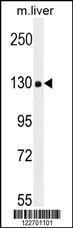 Anti-COL18A1 Rabbit Polyclonal Antibody (FITC (Fluorescein Isothiocyanate))