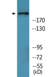 Anti-BRCA1 Rabbit Polyclonal Antibody