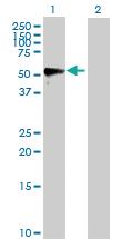 Anti-MMP1 Rabbit Polyclonal Antibody