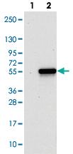 Anti-TWISTNB Rabbit Polyclonal Antibody