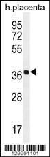 Anti-OR5AS1 Rabbit Polyclonal Antibody (HRP (Horseradish Peroxidase))