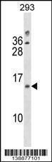 Anti-LIMS3 Rabbit Polyclonal Antibody (PE (Phycoerythrin))