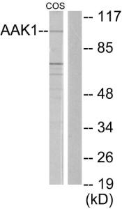 Antibody anti-AAK1 A98307-100 100 µg