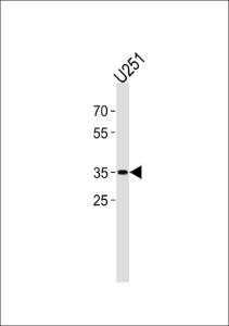 Anti-JUN Rabbit Polyclonal Antibody (FITC (Fluorescein Isothiocyanate))