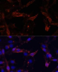 Immunofluorescence analysis of HeLa cells using Anti-CD44 Antibody (A309094) at a dilution of 1:100. DAPI was used to stain the cell nuclei (blue).