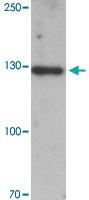 Anti-MYBPC1 Rabbit Polyclonal Antibody