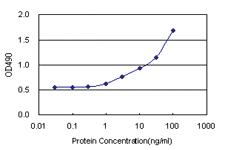 Anti-LGALS1 Antibody Pair