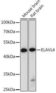 Western blot analysis of extracts of various cell lines, using Anti-HuD Antibody (A8714) at 1:1,000 dilution. The secondary antibody was Goat Anti-Rabbit IgG H&L Antibody (HRP) at 1:10,000 dilution. Lysates/proteins were present at 25µg per lane.