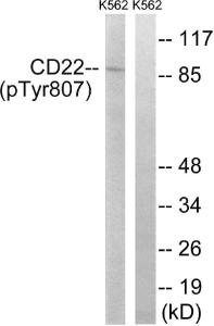 Anti-CD22 Rabbit Polyclonal Antibody