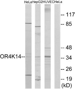 Anti-OR4K14 antibody