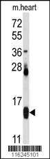 Anti-FABP4 Rabbit Polyclonal Antibody