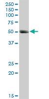 Anti-MMP1 Rabbit Polyclonal Antibody