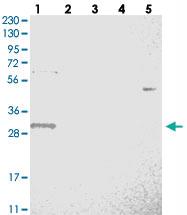 Anti-WBSCR27 Rabbit Polyclonal Antibody