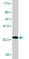 Anti-SMARCB1 Mouse Monoclonal Antibody [clone: 3E10]